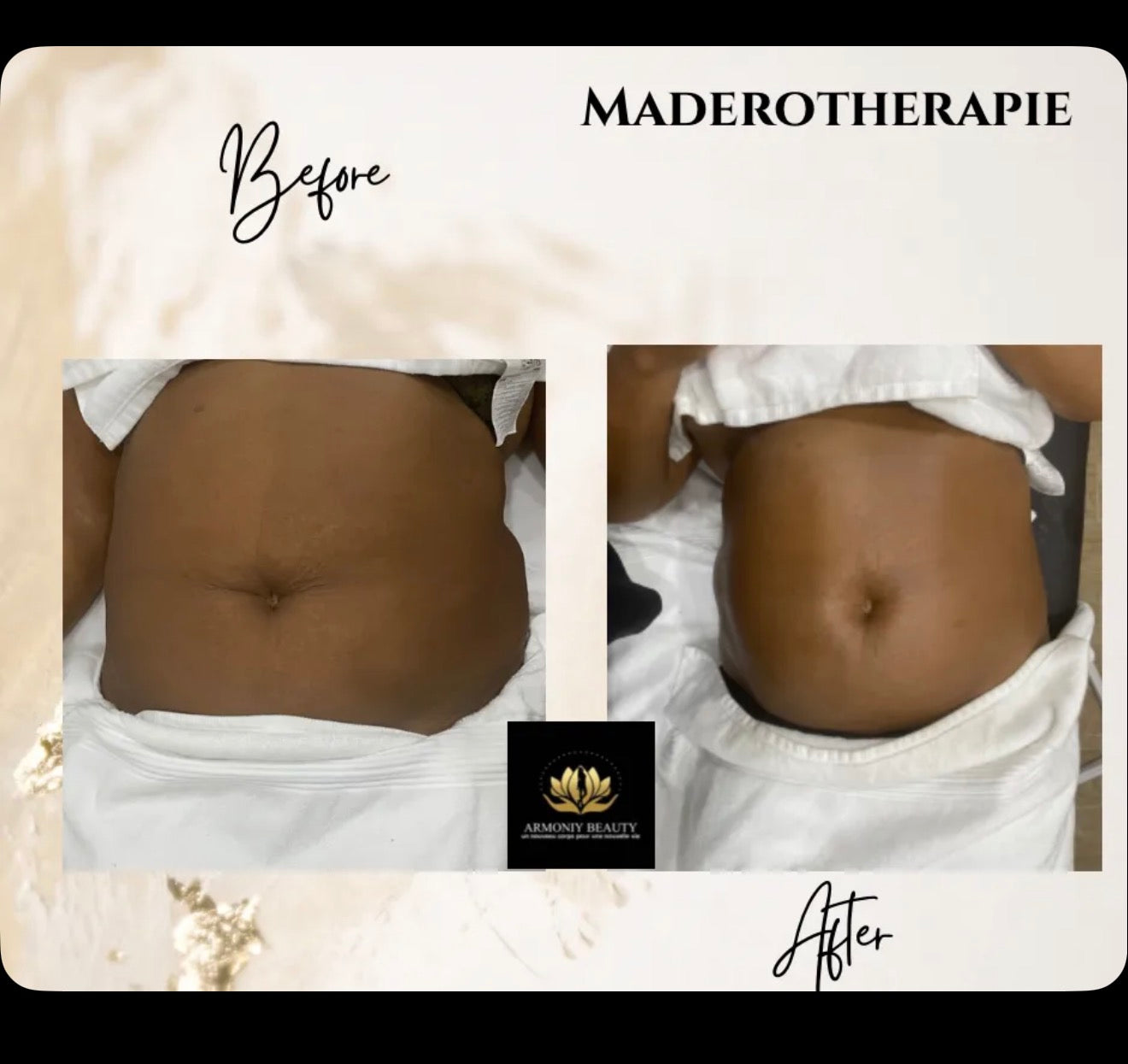 Programme Transformation Ultime ARMONIY BEAUTY™