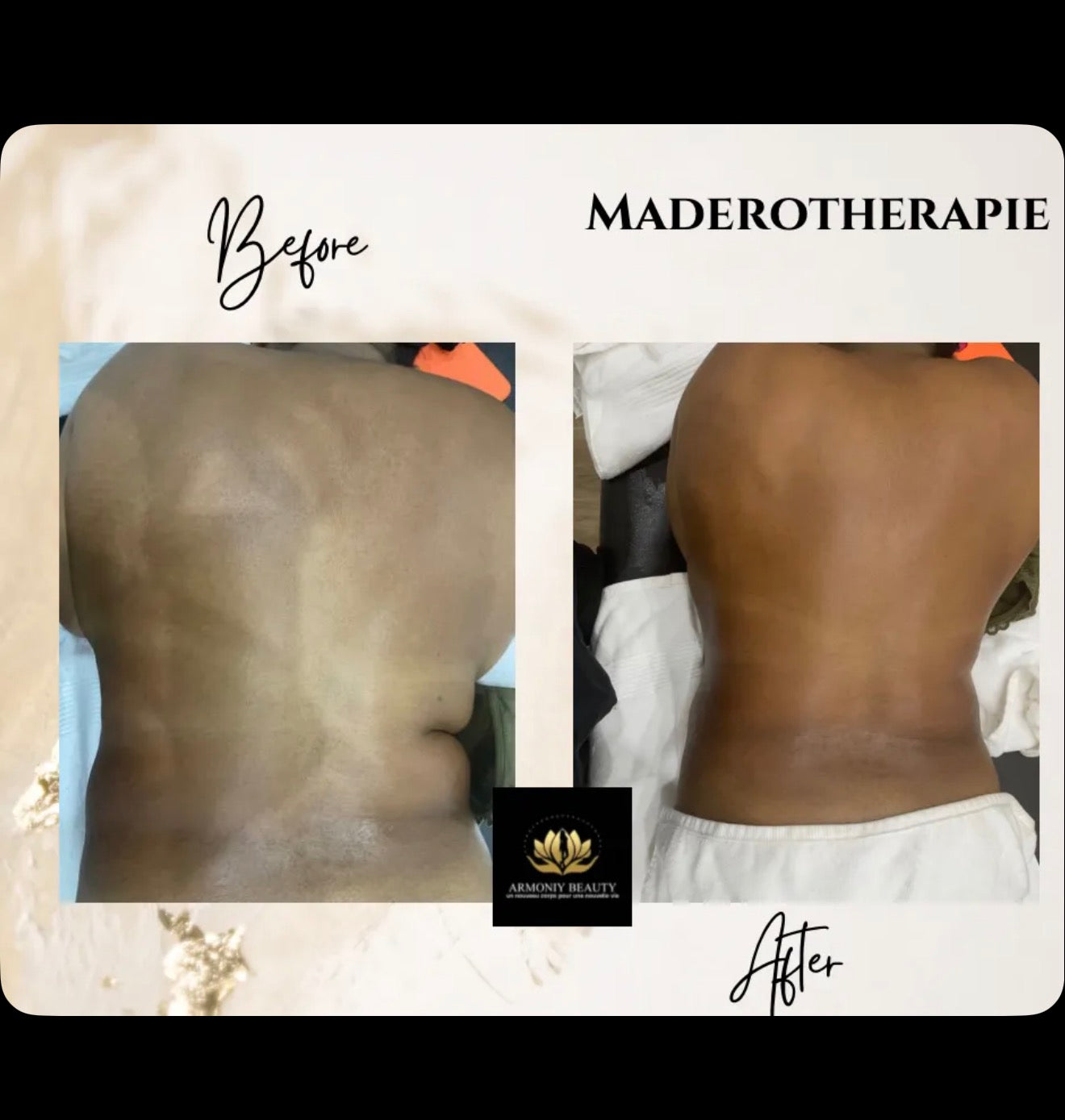 Programme Transformation Ultime ARMONIY BEAUTY™